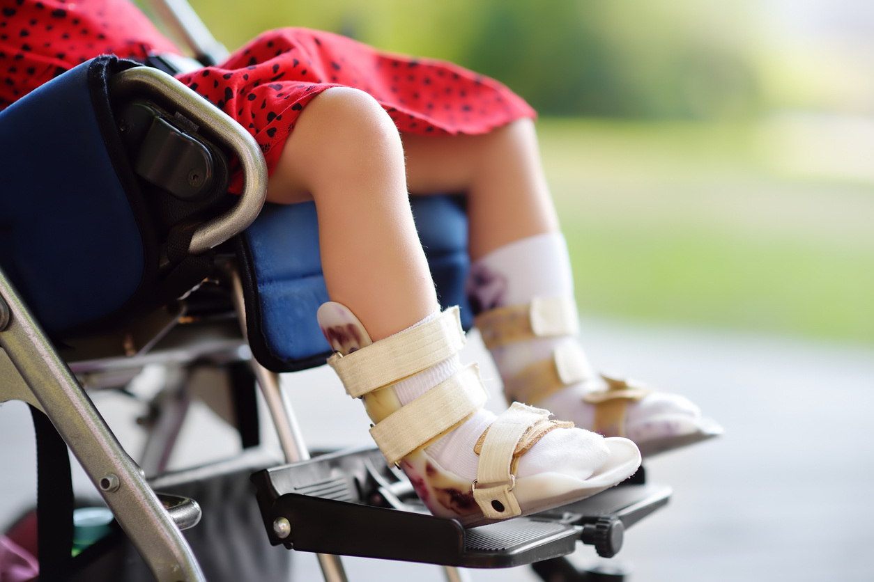 Young girl with cerebral palsy in a wheelchair